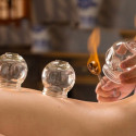 Cupping Therapeutic Massage